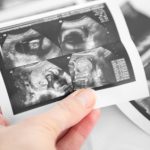 ultrasound boy or girl
