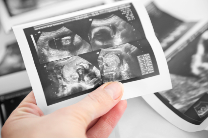 ultrasound boy or girl